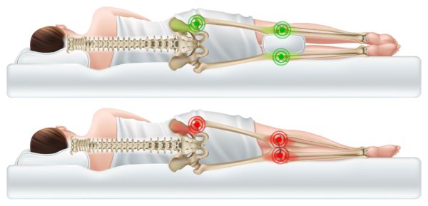 Shockwave Therapy For Greater Trochanteric Pain Syndrome Gtps