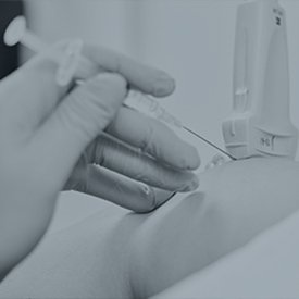 Ultrasound Guided Injections