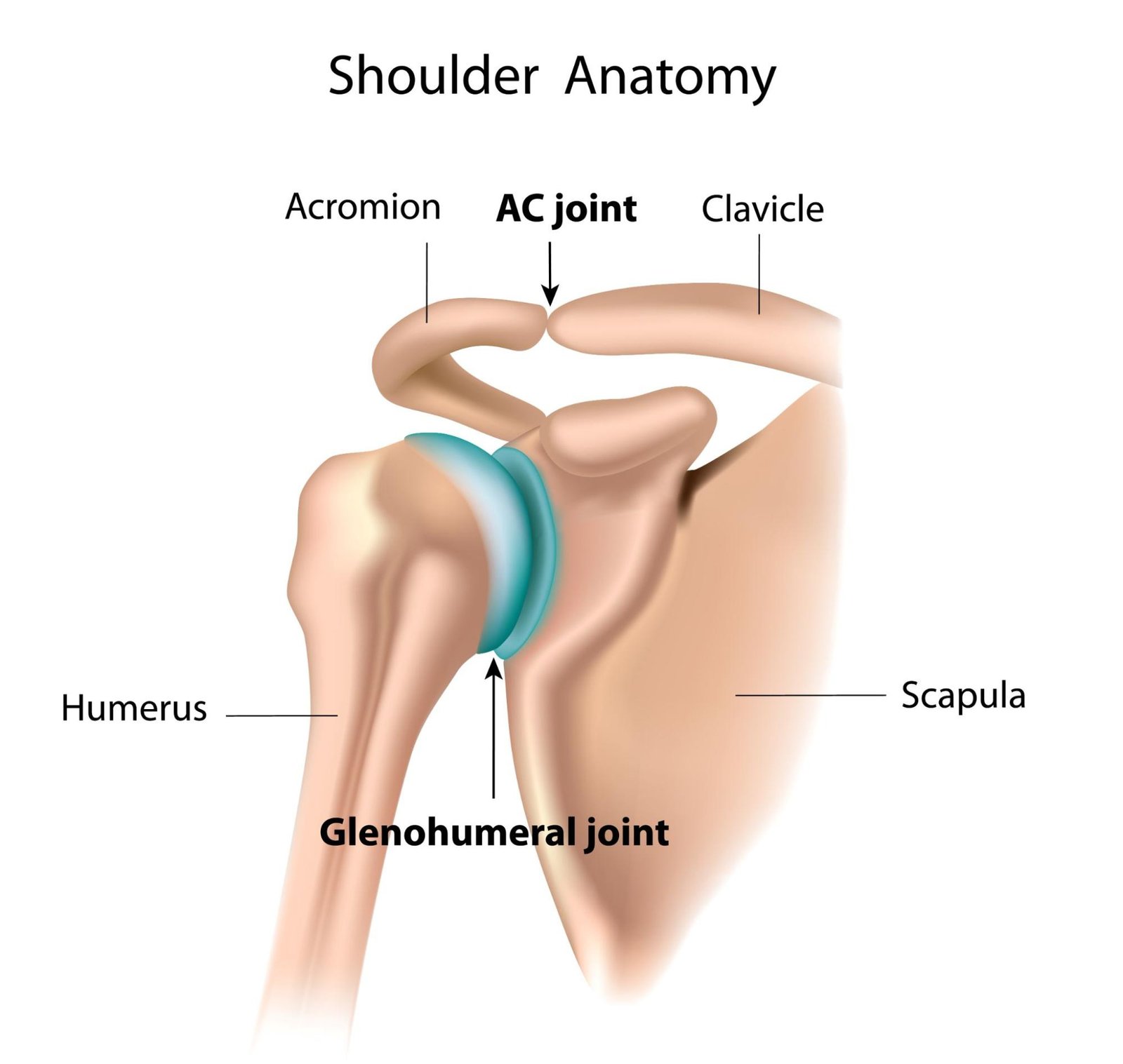 Acromioclavicular joint Pain (ACJ)?