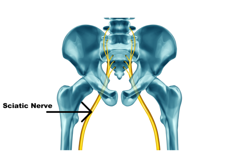 Back Pain | Complete Physio