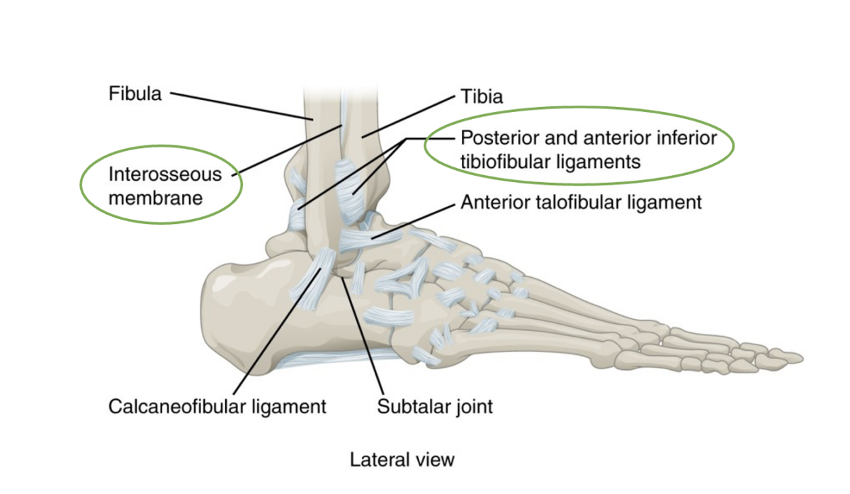 High Ankle Sprain (Syndesmosis Injury) | Complete Physio