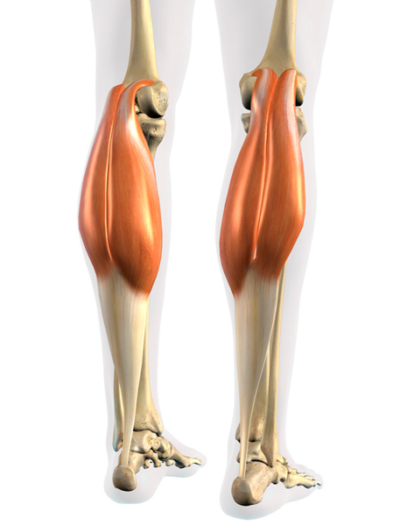 Calf Tear - Tennis Leg | Complete Physio