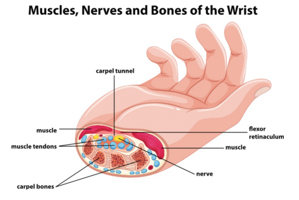 Carpal Tunnel Syndrome - Wrist - Conditions - Musculoskeletal