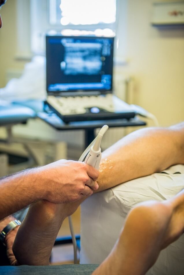 An ultrasound scan of an Achilles Tendon injury