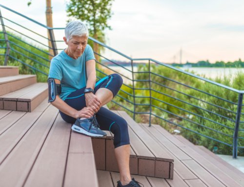 High Ankle Sprain (Syndesmosis Injury)