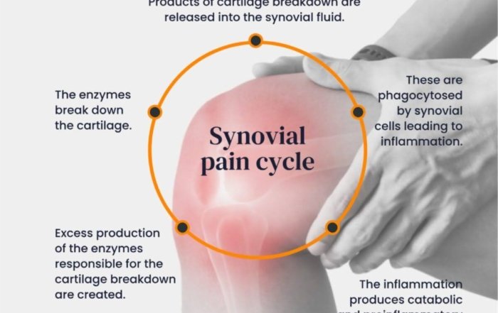 Synovial Pain Cycle