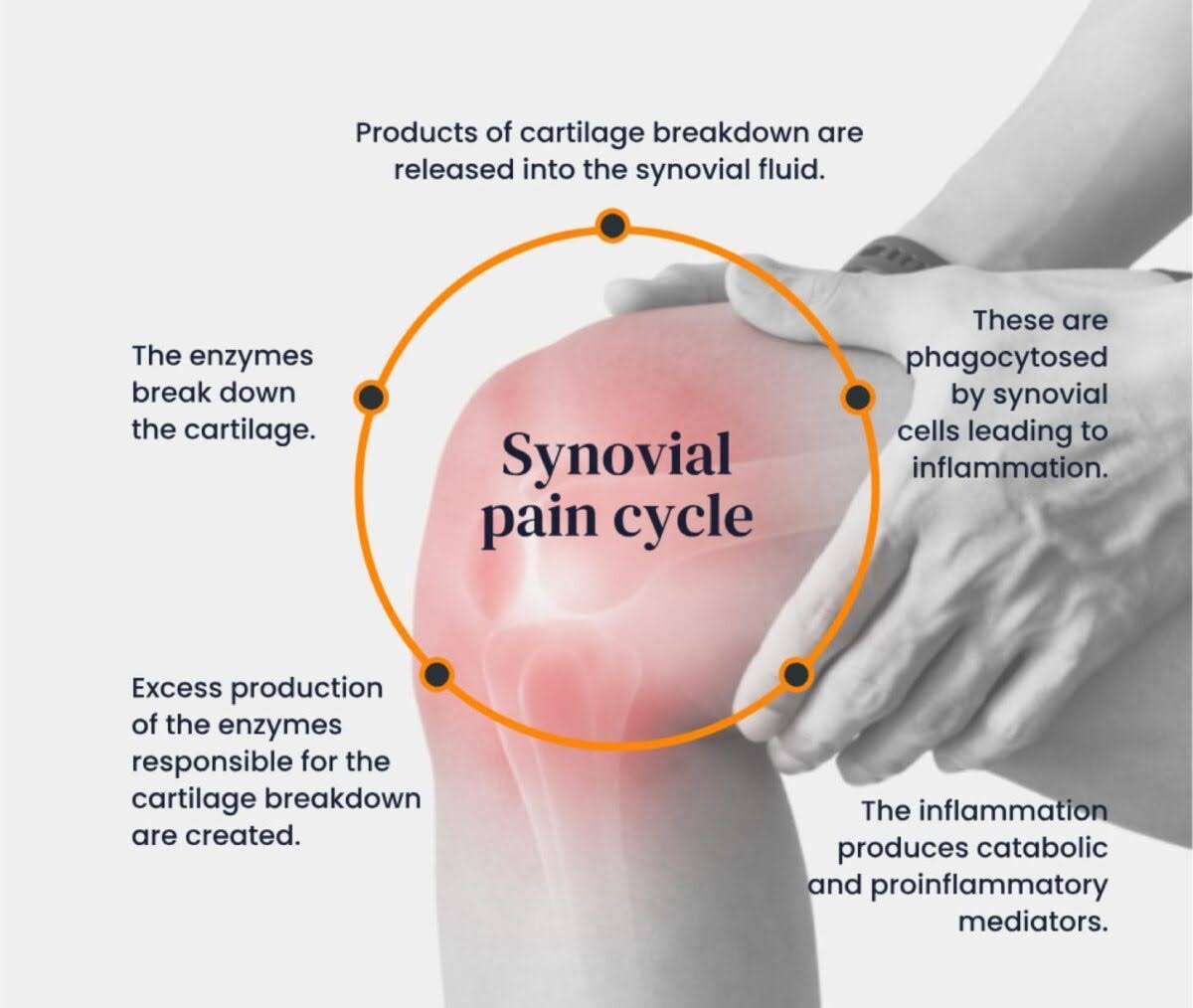 Synovial Pain Cycle
