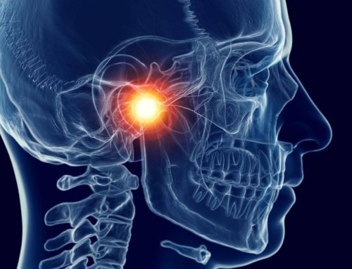 Temporomandibular Joint (TMJ) Dysfunction